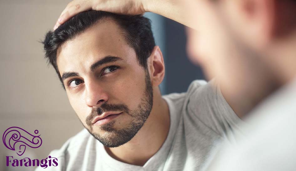 اکستنشن مو برای آقایان
